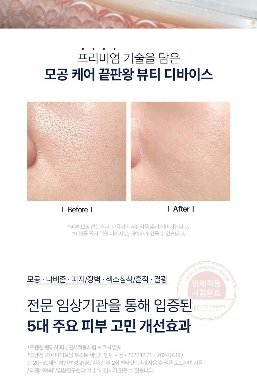 [7중모공케어] 셀로라바이 포텐션 펜타샷 상세페이지 3
